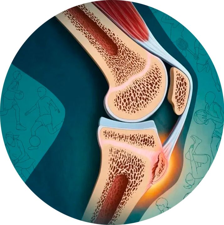 Die Struktur des Gelenks und des umgebenden Gewebes.