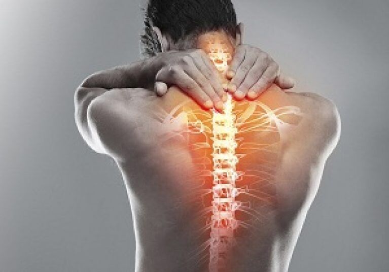 Bei der thorakalen Osteochondrose verändert sich die Struktur des Knochengewebes der Wirbel.